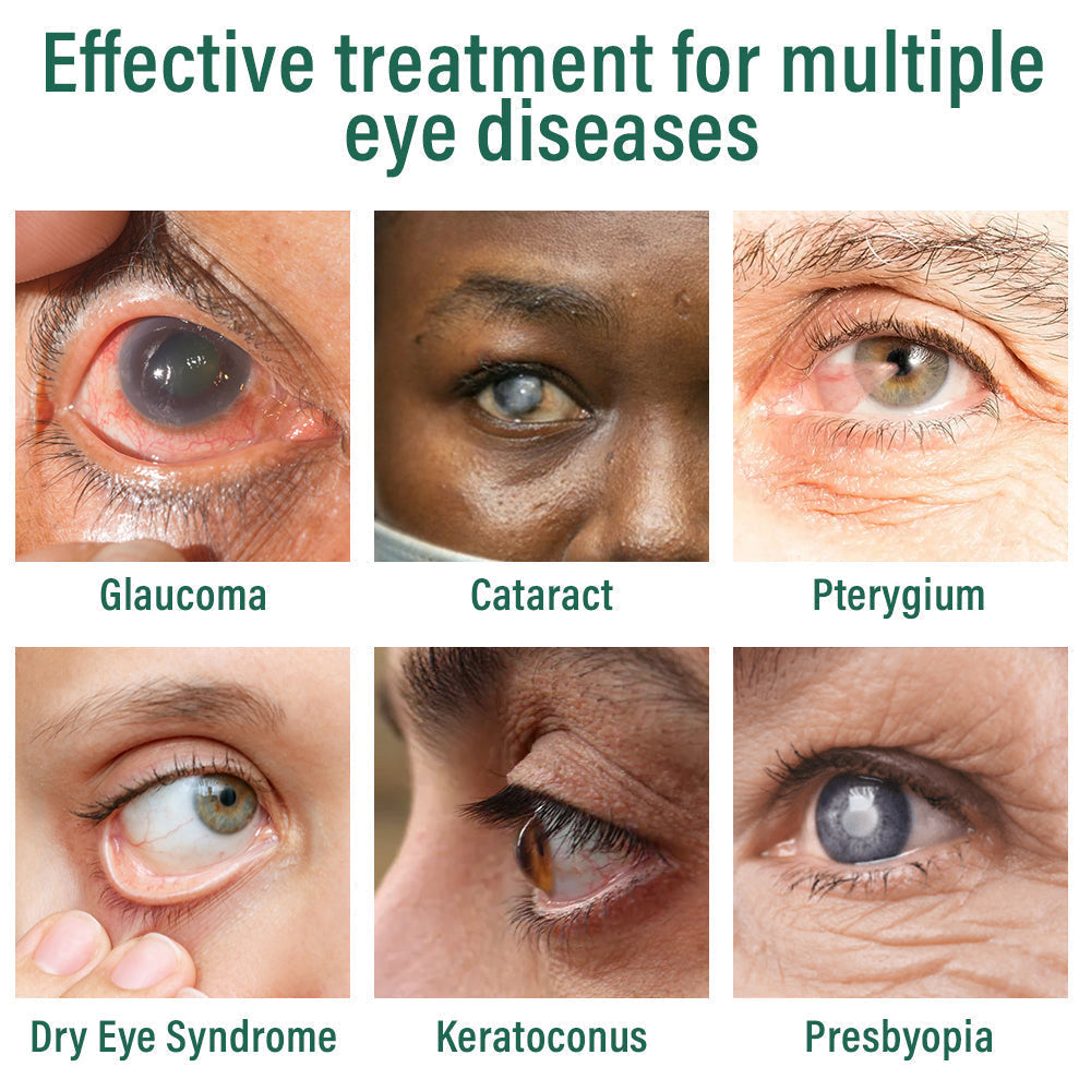 ringmaq Nano Eye Drops Serum ✅FDA Approved(Suitable for presbyopia, dry eye syndrome, glaucoma, and cataracts) 👀