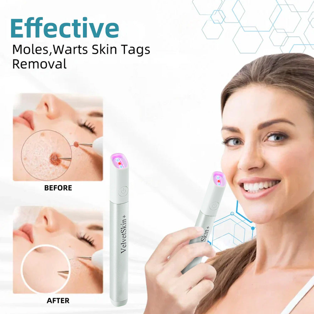 💯ringmiow All-in-One CO₂ Laser Eraser Pen | Removes Moles, Warts, Skin Flaws & Pigmentation