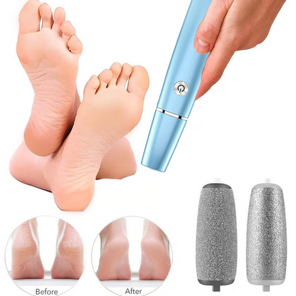 Electric Feet Callus Remover?