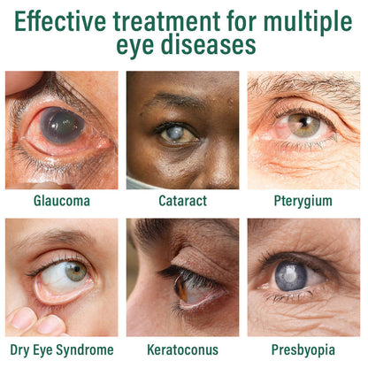 ringmaq Nano Eye Drops Serum ✅FDA Approved(Suitable for presbyopia, dry eye syndrome, glaucoma, and cataracts) 👀