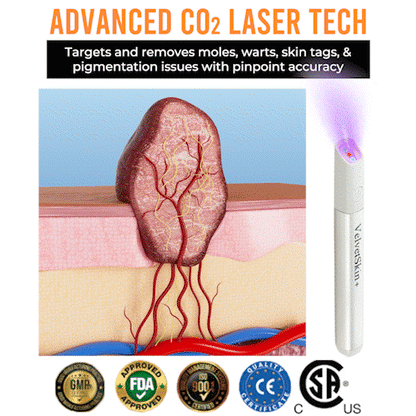 💯ringmiow All-in-One CO₂ Laser Eraser Pen | Removes Moles, Warts, Skin Flaws & Pigmentation