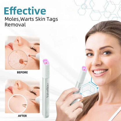 💯ringmiow All-in-One CO₂ Laser Eraser Pen | Removes Moles, Warts, Skin Flaws & Pigmentation